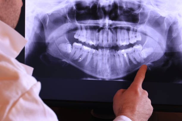Best Emergency Tooth Extraction  in Combine, TX